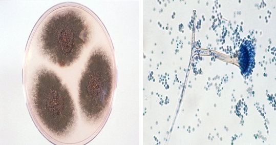 性炎症,化脓性改变或肉芽肿形成(2)组织内曲霉:-镜下菌丝常呈45°分枝