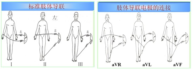 胸导联:探查电极位于胸前区,左右上肢和左下肢各通过一个5千欧姆的