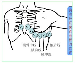 胸导联:探查电极位于胸前区,左右上肢和左下肢各通过一个5千欧姆的