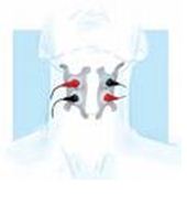 为什么要做吞咽仪器华医网 讲义_https://www.jmylbn.com_新闻资讯_第3张