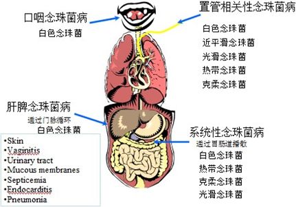复旦大学附属中山医院呼吸科 李华茵
