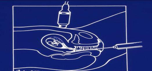 中国医科大学附属盛京医院乔宠