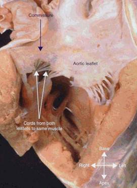 二尖瓣的乳头肌通常都粗大成对,并且位于左心室游离壁的前下和后上方