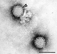 reovirus