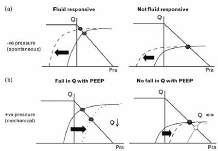 静脉回流曲线(cvp)和右心功能的关系